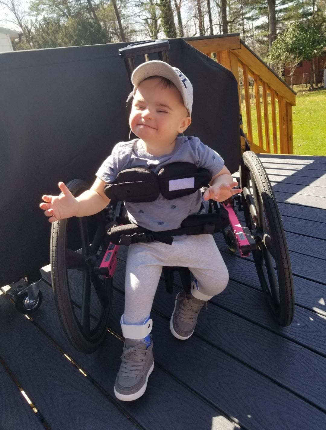 Tommy wearing his new leg braces from the Family Fund